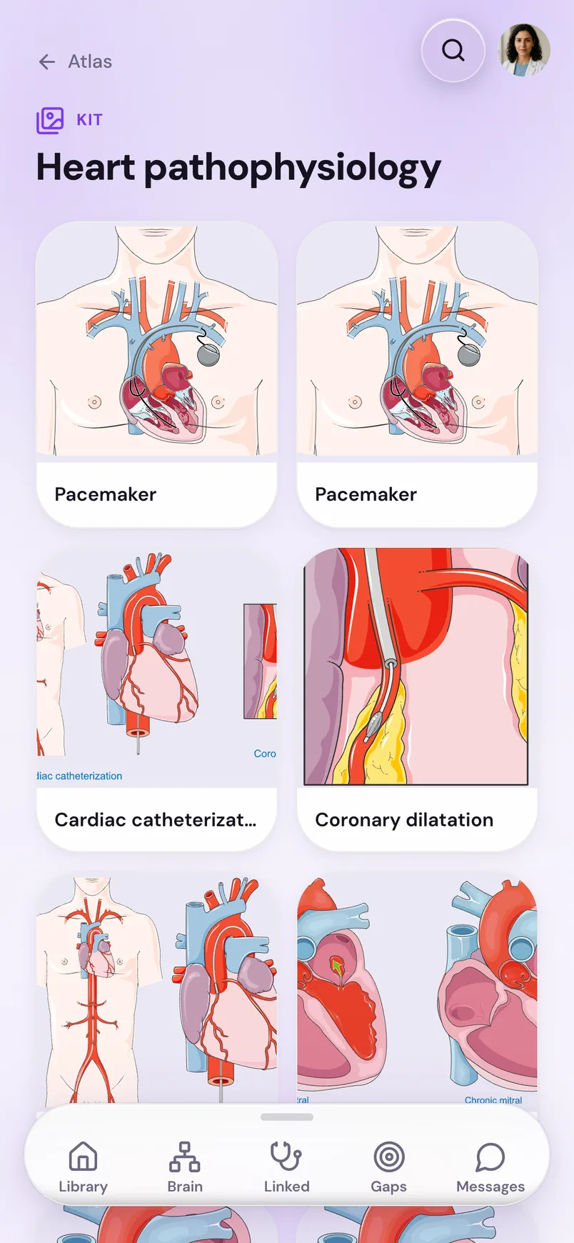 Suture auf dem Smartphone: das Atlas-Kit Heart pathophysiology, ein Raster mit Herz-Illustrationen von Servier Medical Art