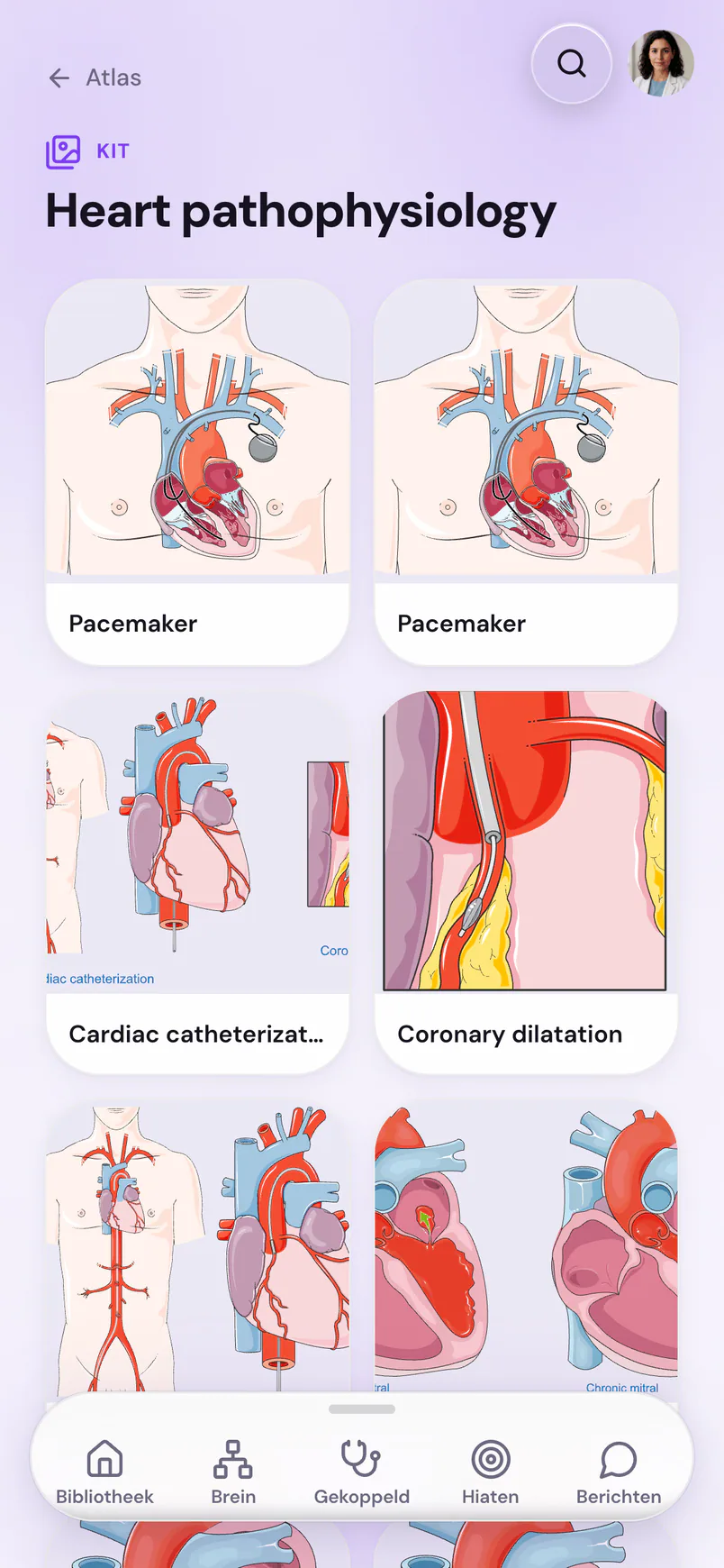 Suture op een telefoon: de atlaskit Heart pathophysiology, een raster met hartillustraties van Servier Medical Art